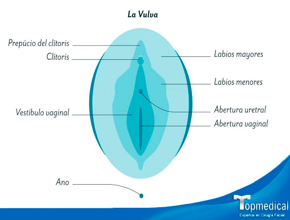 La hipertrofia de labios menores HLM es una variante anatómica de los genit...